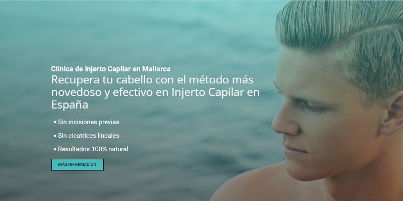 Las 3 Mejores Clínicas de Injerto Capilar en Menorca 3 clinica-dra-maria-asensi
