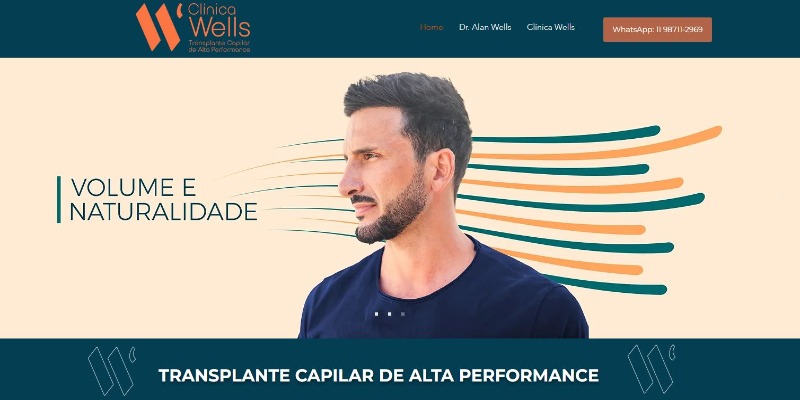 Mejores clínicas de trasplante capilar en Brasil 4 clinica-wells